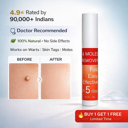 Tags & Moles Remover - Buy 1 Get 1 FREE
