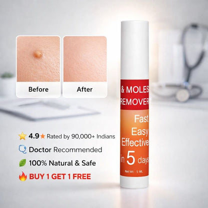 Tags & Moles Remover - Buy 1 Get 1 FREE