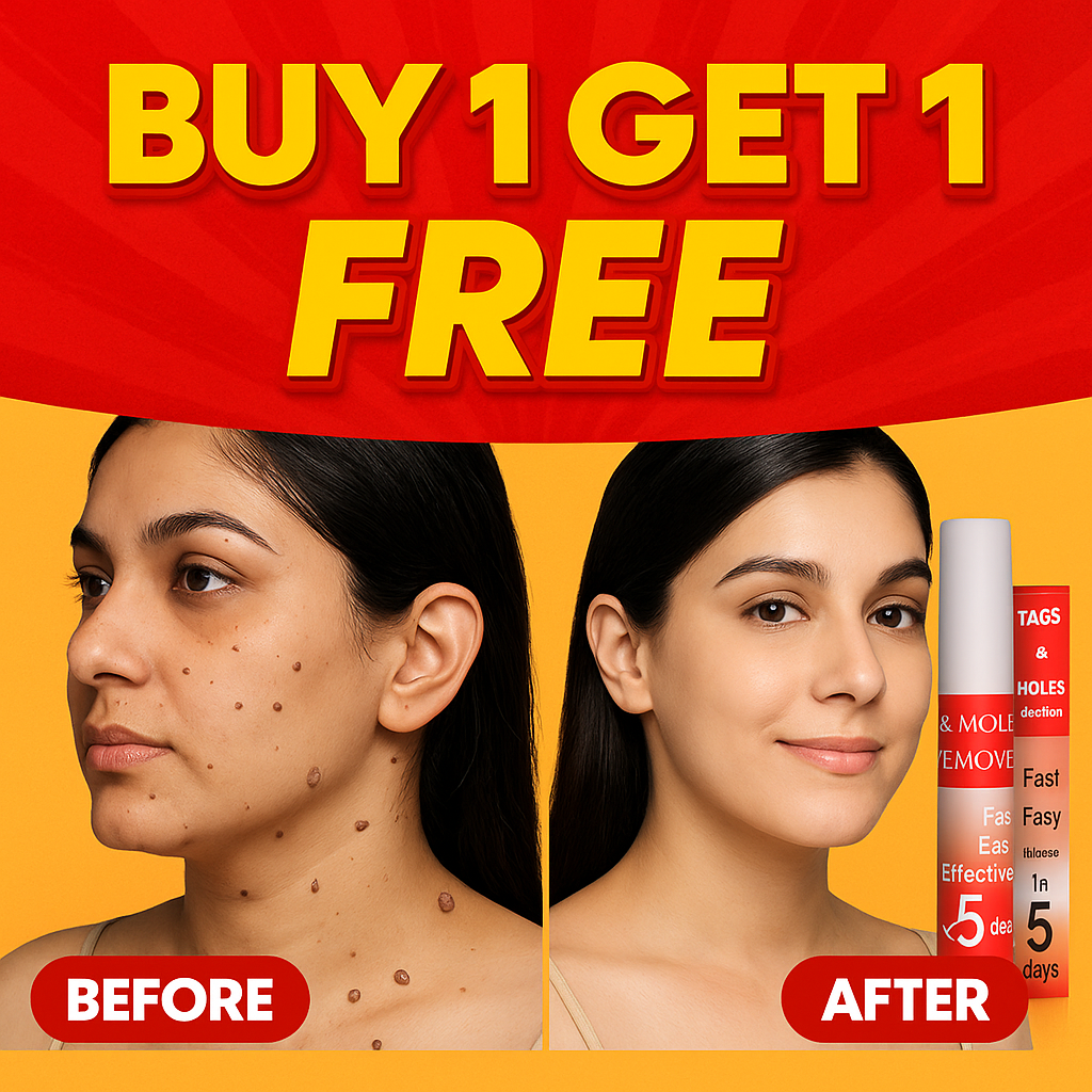 Tags & Moles Remover - Buy 1 Get 1 FREE
