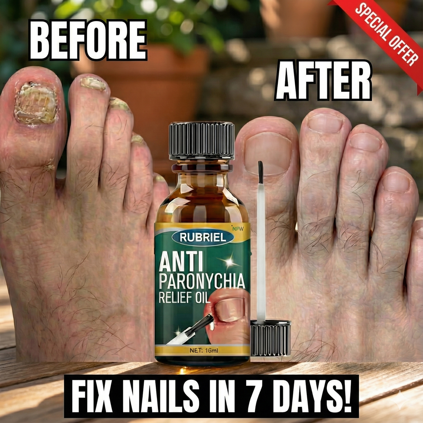 Anti Paronychia Relief Oil (Buy 1 Get 1 FREE)