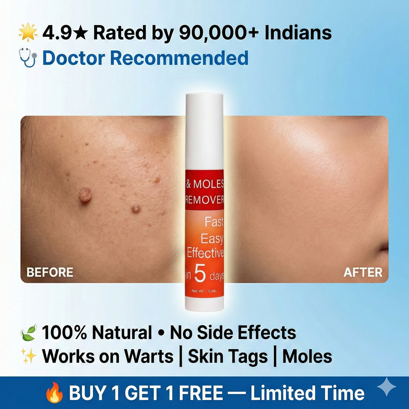 Tags & Moles Remover - Buy 1 Get 1 FREE