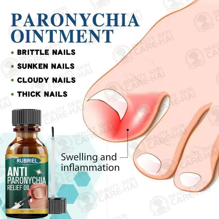 Anti Paronychia Relief Oil (Buy 1 Get 1 FREE)