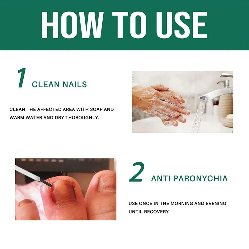 Anti Paronychia Relief Oil (Buy 1 Get 1 FREE)